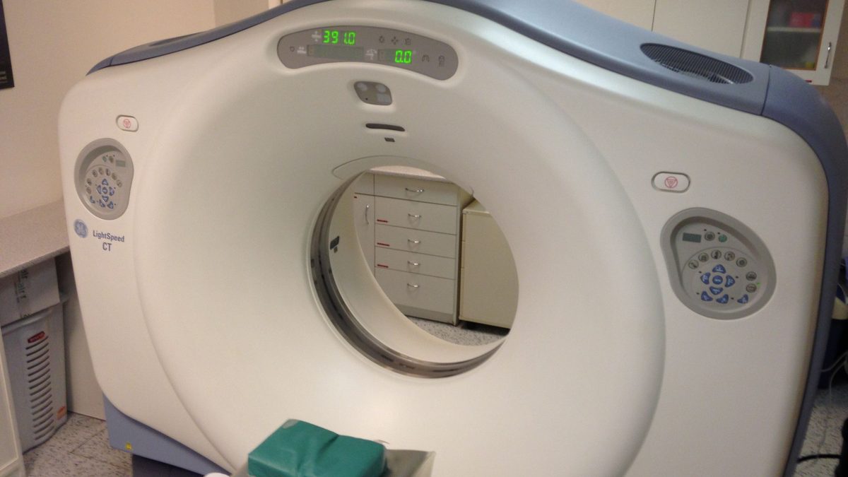 Before your CT, cardiac cath or MRI: iodinated and gadolinium contrast — risks, prevention and the questions kidney patients should ask